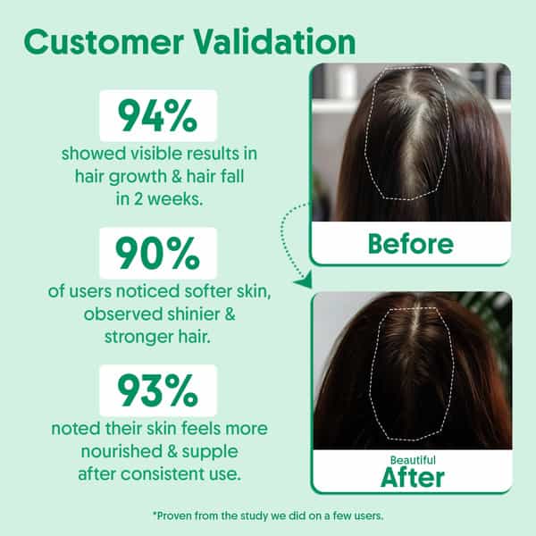 Aravi Organic Rosemary Lavender Hair Growth Oil - Strengthens Hair - 200Ml