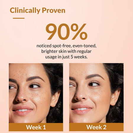 Fixderma Kojic Acid + Arbutin Skarfix-Plus Cream For Hyperpigmentation And Melasma Treatment 30 Gm