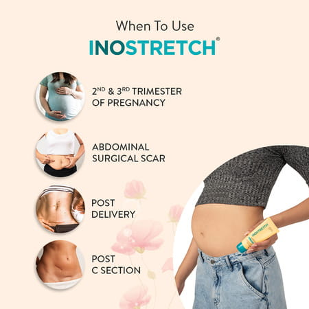 Inostretch Stretch Mark Cream | Reduce Stretch Marks & Scars - 60g (Pack Of 2)