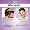 Bake 0.5mm Derma Roller 540 Needles For Skin Renewal | Hair Growth And Scar Reduction