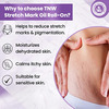 Tnw-The Natural Wash Stretch Mark Oil With Roll On For Reducing Scars & Pigmentation