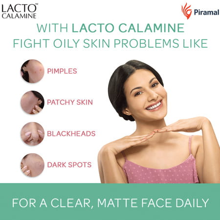 Lacto Calamine Face Lotion Kaolin Clay With Aloe Vera Normal Skin 60 Ml