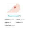 Maxiocel Wound Care Dressing For Diabetic Foot Ulcers (5Cm X 10Cm) - Box Of 10 Units