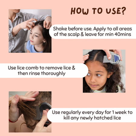 Coco Crush Ayurvedic Anti Lice Hair Spray | Kills Lice/Eggs/Nits | 100% Naturally - 100ml