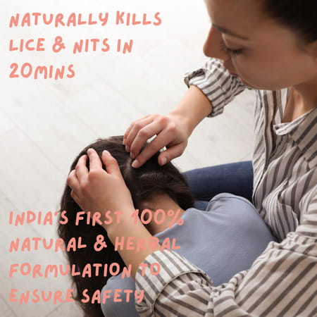 Coco Crush Ayurvedic Anti Lice Hair Spray | Kills Lice/Eggs/Nits | 100% Naturally - 100ml