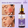 Newish Rosemary Essential Oil For Hair Growth Skin Therapeutic Grade And Diffuser Aroma 30Ml