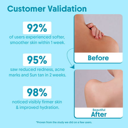 Aravi Organic 2% Salicylic Acid Body Wash With Niacinamide & Blueberry - 300ml