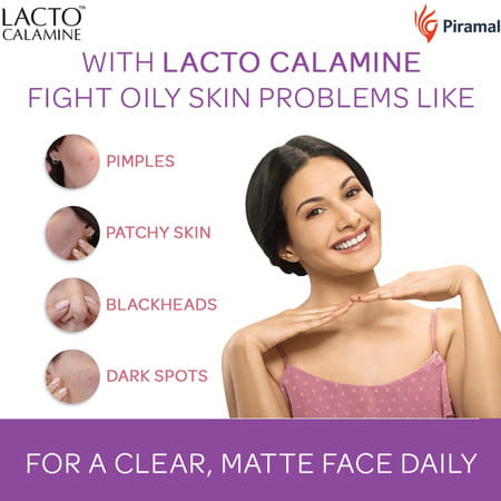 Lacto Calamine Oil Control Face Lotion | For Oily Skin | 60 Ml
