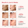 Yourhappyskin Reglow Face Serum | Brighter Skin Tone | Advanced Pigmentation Control - 30ml