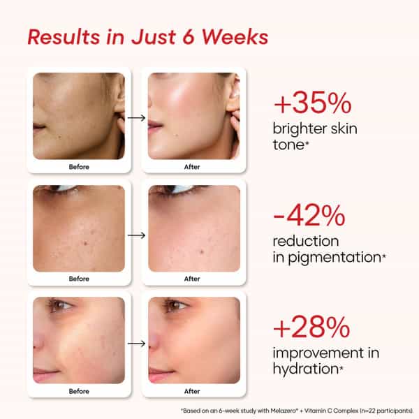 Yourhappyskin Reglow Face Serum | Brighter Skin Tone | Advanced Pigmentation Control - 30Ml