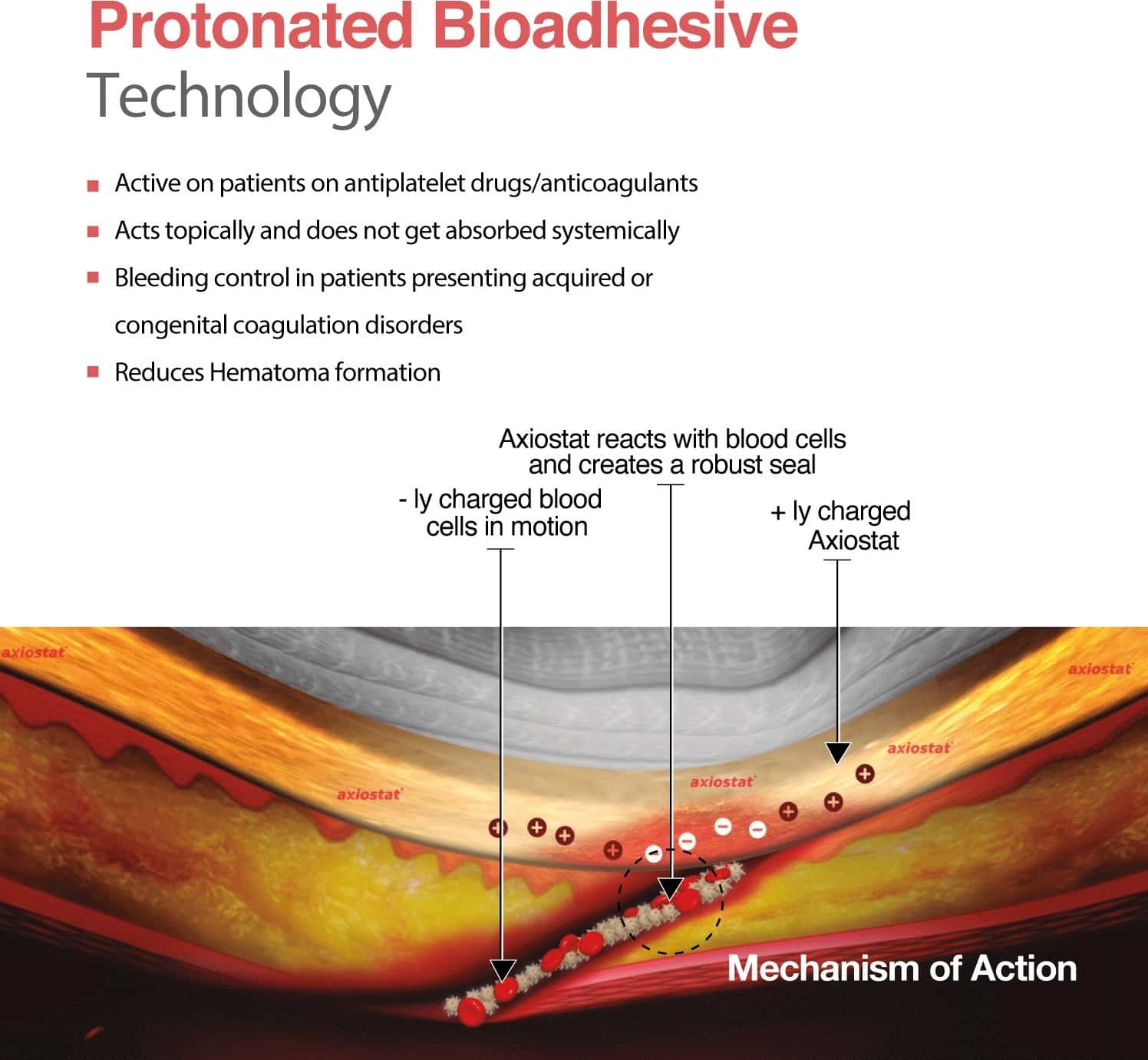 Buy AXIOSTAT DENTAL HAEMOSTATIC DRESSING 40 N Online & Get Upto 60