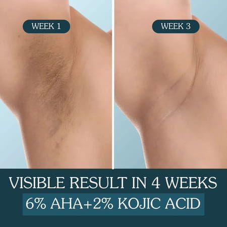 Bake 6% Aha Brightening Underarm Roll-On Serum | Dark Underarms Elbows Knees Odour & Sweat - 50Ml