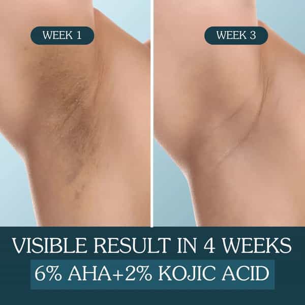Bake 6% Aha Brightening Underarm Roll-On Serum | Dark Underarms Elbows Knees Odour & Sweat - 50Ml