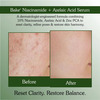 Bake 10% Niacinamide Face Serum With Azelaic For Acne Marks | Dark Spots & Oil Control (30Ml)
