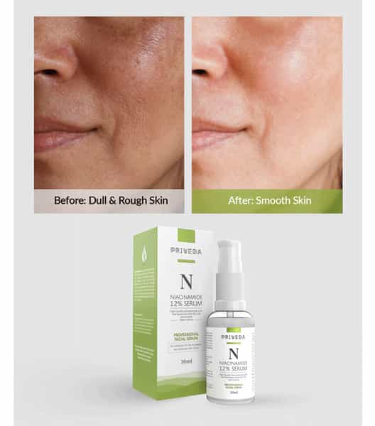 Priveda Niacinamide Face Serum For Acne Marks And Acne Prone Skin For Men And Women (30 Ml)