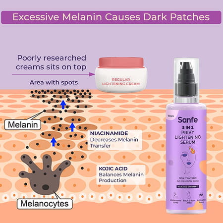 Sanfe Spotlite Sensitive Body Serum For Dark Underarms | Inner Thighs And Sensitive Areas 50g