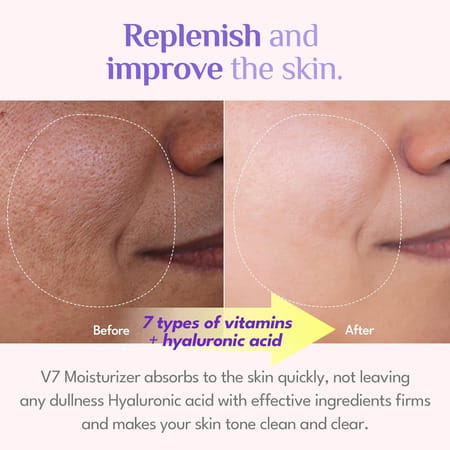 It's Skin V7 Hyaluronic Moisturizer - Korean Skincare - For Moisturisation - Hydration - 50Ml