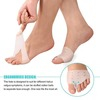 Skudgear 2-In-1 Pack Of One Pair Bunion Corrector Toe Separator + One Pair Of Toes Aligner Foot Pad