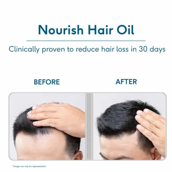 Hk Vitals Headful Nourish Hair Oil With Rosemary | Amla For Hair Growth | 100 Ml