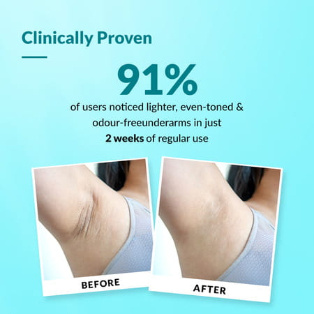 Fixderma Nigrifix Underarm Ocean Roll On With 6% Aha,Lactic Acid Brightens Underarm 60 Ml