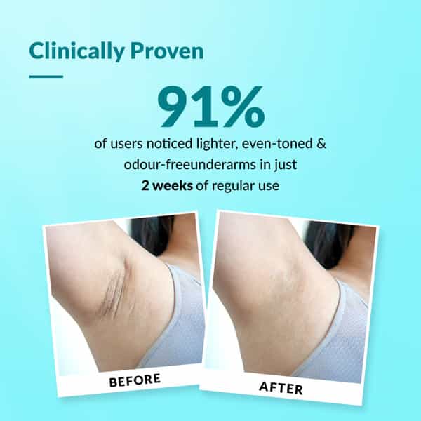 Fixderma Nigrifix Underarm Ocean Roll On With 6% Aha | Lactic Acid Brightens Underarm 60 Ml