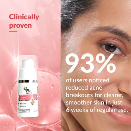 Fixderma Acne Defence Face Serum | Powered With 2% Salicylic Acid For Acne Free Skin - 10g