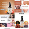 Tnw-The Natural Wash Vitamin C Face Serum | Skin Clearing Serum | Lip Balm