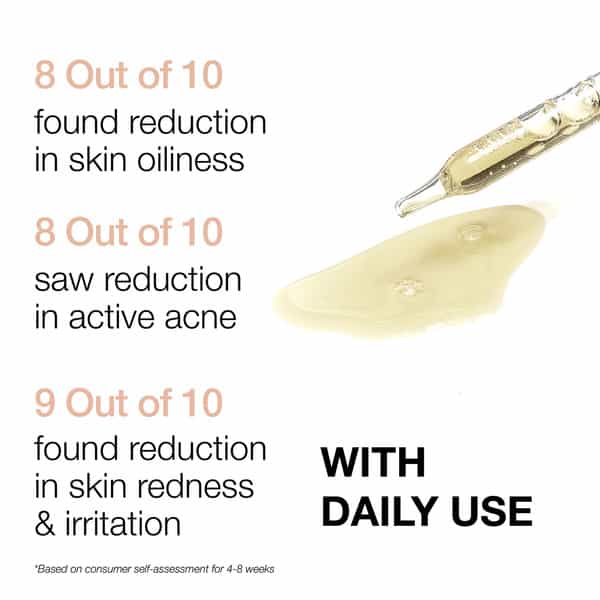 Minimalist 17% Azeclair Anti-Acne Face Serum For Men & Women Azelaic Acid Derivative With Propolis