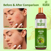 Newish Cold Pressed Organic Neem Oil For Skin & Hair 200Ml