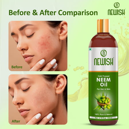 Newish Cold Pressed Organic Neem Oil For Skin & Hair 200Ml