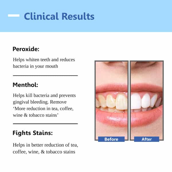 Oralvit Teeth Whitening Pen |Vegan | Enamel-Safe| Removes Stains & Whitens Teeth | Unisex - 2Ml