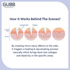 Gubb Derma Roller 0.5Mm For Hair Regrowth Face Acne Scars & Skin Aging 540 Micro Needles - Red
