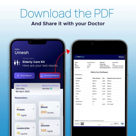 Neodocs Elderly Care Kit | Instant At-Home Urine Test | Track 10+ Parameters | Liver|Kidney More