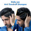 Scalpe Anti Hairfall Shampoo - Caffeine | Biotin | Saw Palmetto | Argan Oil For Women & Men 200Ml