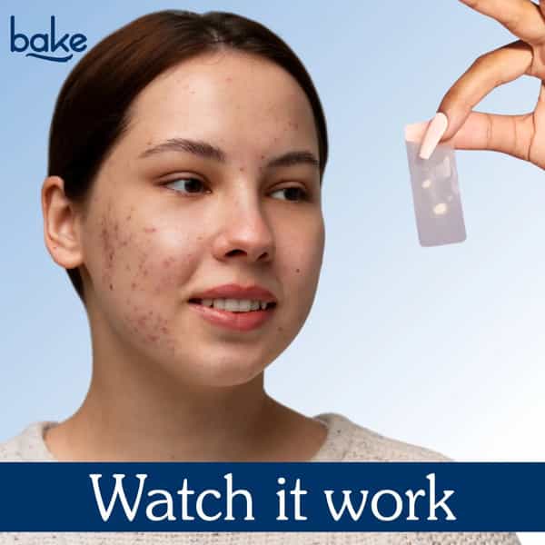 Bake 2% Salicylic Acid Hydrocolloid Acne Patches Xl For Pimples & Blackheads (10 Patches)
