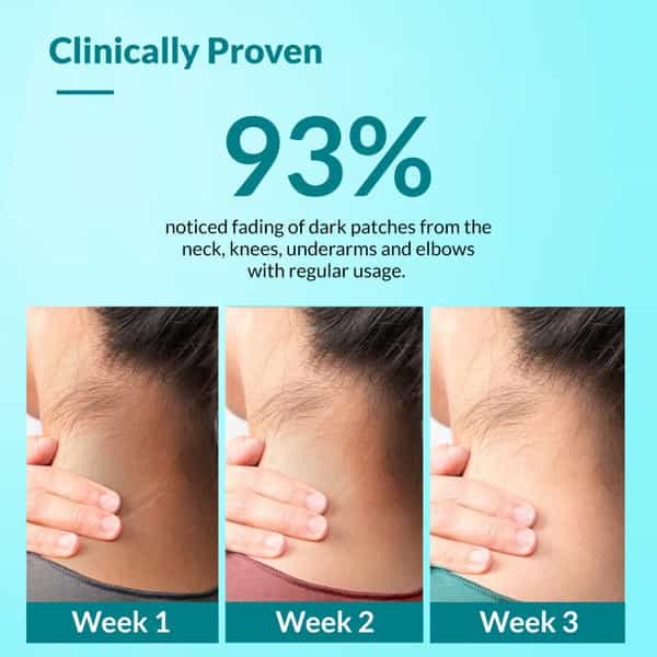 Fixderma Nigrifix | Cream | Tube 50 Gm