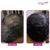 Bontress Pro+ Scalp Serum | 5% Capixyl | 3% Redensyl | 3% Anagain | 3% Procapil | 30 Ml