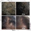 Bontress Pro+ Scalp Serum | 5% Capixyl | 3% Redensyl | 3% Anagain | 3% Procapil | 30 Ml
