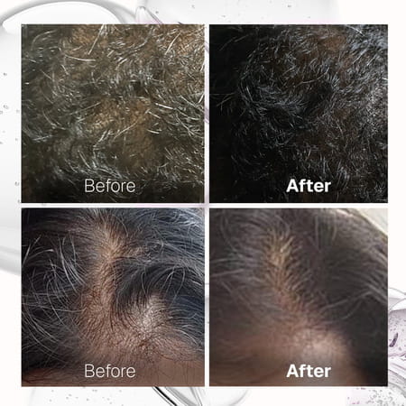 Bontress Pro+ Scalp Serum | 5% Capixyl | 3% Redensyl | 3% Anagain | 3% Procapil | 30 Ml