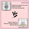 Kozicare Under Arm Cream For Remove Black Spots & Warts - 50Gm