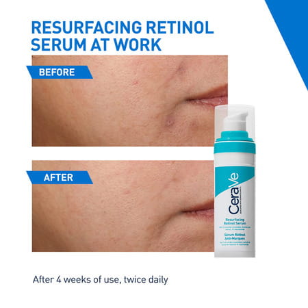 Cerave Resurfacing Retinol Serum, Reduces Acne Marks With Licorice Root Extract & Niacinamide 30ml
