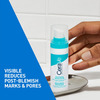 Cerave Resurfacing Retinol Serum | Reduces Acne Marks With Licorice Root Extract & Niacinamide 30ml