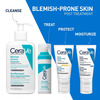 Cerave Resurfacing Retinol Serum | Reduces Acne Marks With Licorice Root Extract & Niacinamide 30ml
