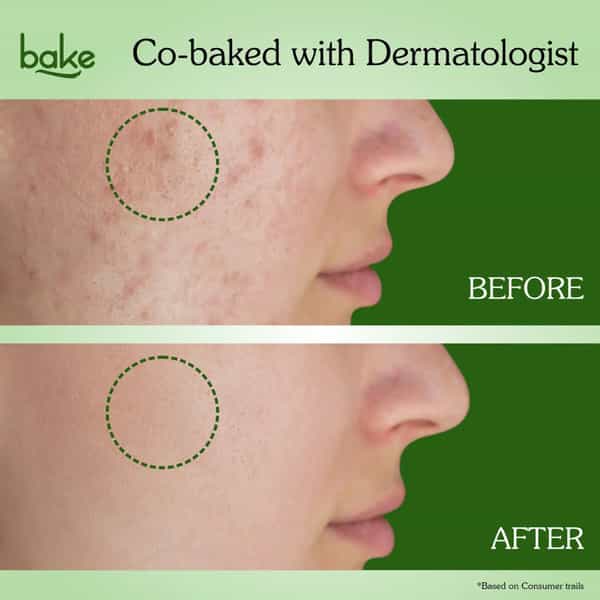 Bake 3% Niacinamide + 2% Salicylic Acid Face Wash For Acne | Marks & Oil Control - 100Ml