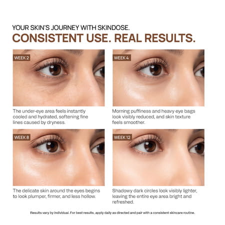 Yuderma Yuvenex 3X Contoura Care Under Eye Gel | 25 Ml