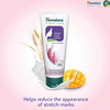 Himalaya Stretch Mark Cream Tube Of 100 Ml