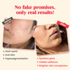 Chicnutrix Outshine-Skin Glow Serum With Vitamin C | Glutathione | Arbutin | Niacinamide