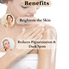 Vigini Skin Lightening Brightening Body Whitening Underarm Tan Pigmentation Removal Kojic Acid Cream
