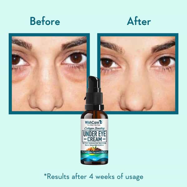 Wishcare Collagen Boosting Under Eye Cream For Dark Circle- Coffee & Almond (30Ml)