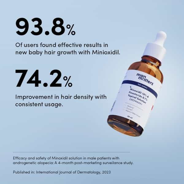 Man Matters Growmax+ Minoxidil 10% With 0.1% Finasteride Serum I Prevent Hair Loss | Thinning | 50Ml